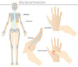 rückenschmerzen - reflexzonenmassage