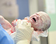 Newborn Baby After Caesarean Section 3