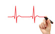Hand drawing ECG