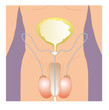 Urogenital männlich vergrößert