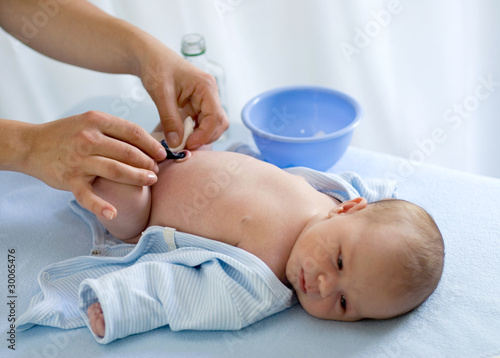 Photo: taking care of baby's navel taking care of baby's navel