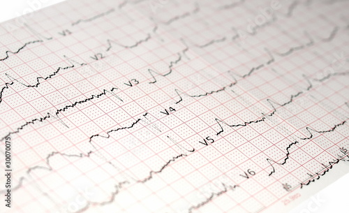 Photo: green graph brain wave EEG isolated on white background green graph brain wave EEG isolated on white background