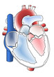 Corazon 3