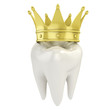 Illustration: single tooth with golden crown 3d illustration single tooth with golden crown 3d illustration