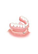 Odontología implante