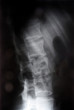 X-ray
