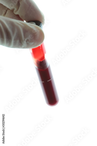 Photo: Blood examination Blood examination