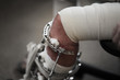Broken leg in metal Ilizarov apparatus. Closeup, shallow DOF.