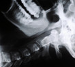 radiograph of human neck
