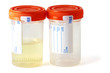 Two specimen bottles Two specimen bottles