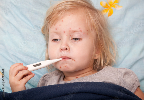 Photo: a sick girl is measuring the temperature a sick girl is measuring the temperature