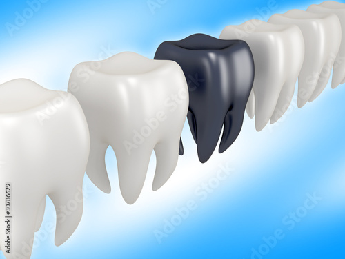 Illustration: tooth tooth