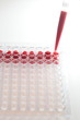 blood examination