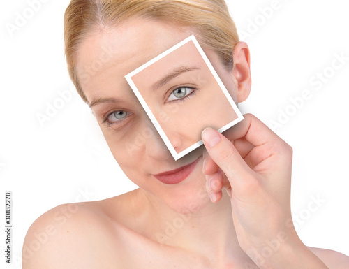 Photo: Beauty Eye Wrinkle Makeover Beauty Eye Wrinkle Makeover
