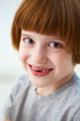 Photo: Closeup portrait of a cute smiling girl missing front teeth Closeup portrait of a cute smiling girl missing front teeth