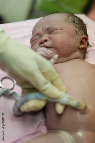 Photo: new born infant in the operation room new born infant in the operation room