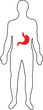 Gastric