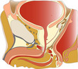 Prostate1