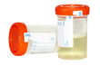 Urine sample and empty collection bottle Urine sample and empty collection bottle