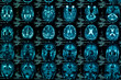 sharp ct scan of the human brain