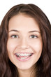 girl with braces