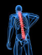 3d rendered medical x-ray illustration -  male backache
