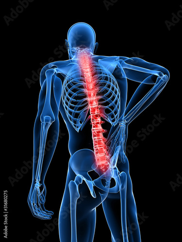 Illustration: 3d rendered medical x-ray illustration - male backache 3d rendered medical x-ray illustration - male backache