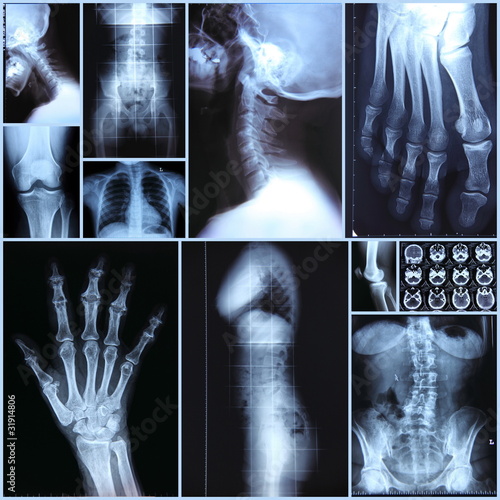 Photo: Radiography Radiography