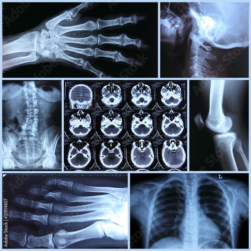 Photo: Radiography Radiography