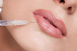 Cosmetic botox injection in the beauty face Cosmetic botox injection in the beauty face