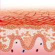 Enfermedad de danier