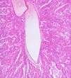 Microscope picture of lymphatic vessel