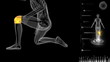 Video: Human bones xray skeleton Human bones xray skeleton