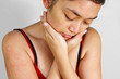 Adult woman with skin allergy rash