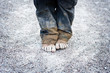 child's dirty feet. poorness concept