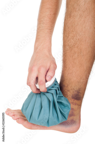 Photo: Icing a sprained ankle Icing a sprained ankle