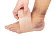 Bandaging a sprained ankle