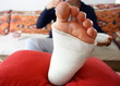 pied plâtré