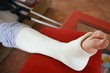 jambe plâtrée et béquilles