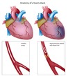 Heart attack, eps8