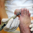 Podiatry - using a tool