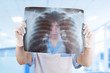 medical doctor looking through x-ray picture of lungs in hospita medical doctor looking through x-ray picture of lungs in hospita