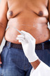 weight loss plastic surgery