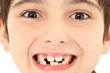 Close Up Missing Teeth