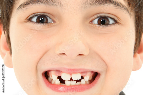 Photo: Close Up Missing Teeth Close Up Missing Teeth