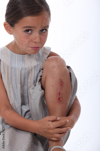 Photo: a little girl with a wounded leg a little girl with a wounded leg