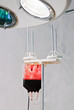 Photo: blood transfusion blood transfusion