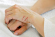 Photo: Scratched arms Scratched arms