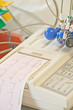 tracciato ecg