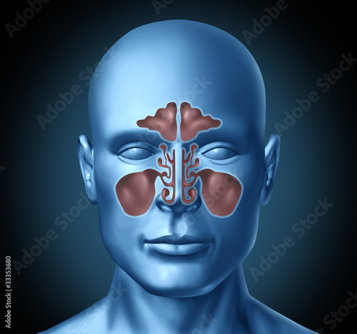Illustration: Sinus human nasal cavity with human head Sinus human nasal cavity with human head